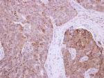 RAB11FIP1 Polyclonal Antibody