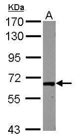 RAB11FIP1 Antibody in Western Blot (WB)