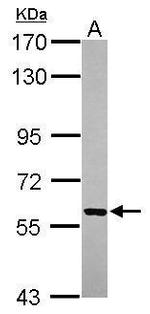 VLK Antibody in Western Blot (WB)