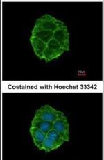 P2X3 Antibody in Immunocytochemistry (ICC/IF)