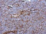 P2X3 Antibody in Immunohistochemistry (Paraffin) (IHC (P))