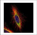 CPT1B Polyclonal Antibody