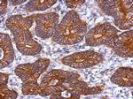 KRT72 Antibody in Immunohistochemistry (Paraffin) (IHC (P))