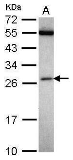 FAAP24 Polyclonal Antibody