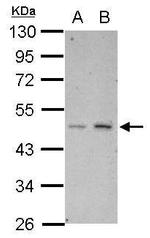 HTRA3 Polyclonal Antibody