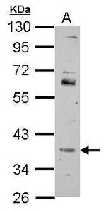 FOXR2 Polyclonal Antibody