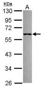 RNF36 Polyclonal Antibody