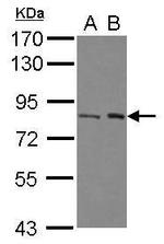 BAAT1 Polyclonal Antibody