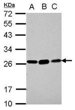 GSTK1 Antibody in Western Blot (WB)