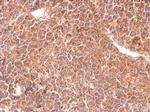 RIT1 Antibody in Immunohistochemistry (Paraffin) (IHC (P))