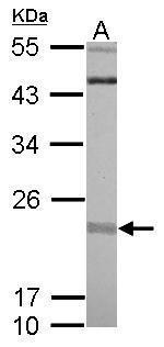 RIT1 Antibody in Western Blot (WB)