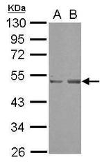 SETD7 Polyclonal Antibody