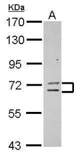 ZNF182 Polyclonal Antibody