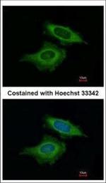 BAG2 Polyclonal Antibody