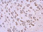 BAG2 Antibody in Immunohistochemistry (Paraffin) (IHC (P))