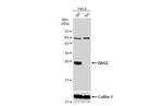 BAG2 Antibody in Western Blot (WB)