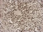 ZNF124 Antibody in Immunohistochemistry (Paraffin) (IHC (P))