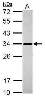 PNP Antibody in Western Blot (WB)