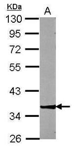 ZNF396 Antibody in Western Blot (WB)