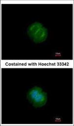 Tankyrase Polyclonal Antibody