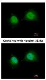 GTF2A1 Polyclonal Antibody