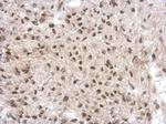 GTF2A1 Antibody in Immunohistochemistry (Paraffin) (IHC (P))