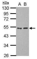 GTF2A1 Antibody in Western Blot (WB)