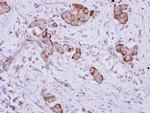 TMPRSS13 Antibody in Immunohistochemistry (Paraffin) (IHC (P))