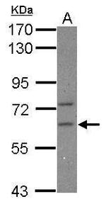 CPEB2 Polyclonal Antibody