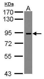ADAM23 Polyclonal Antibody
