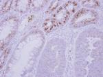 GCKR Polyclonal Antibody