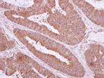 TXNDC6 Polyclonal Antibody