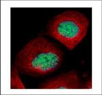 Methyl-p53 (Lys372) Antibody in Immunocytochemistry (ICC/IF)