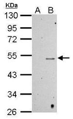 Methyl-p53 (Lys372) Antibody in Western Blot (WB)