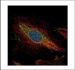PTK9 Polyclonal Antibody