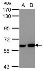 MEF2D Antibody in Western Blot (WB)