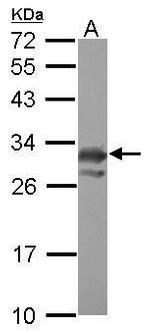 PCMT1 Polyclonal Antibody
