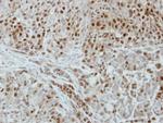 DUT Polyclonal Antibody