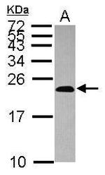 DUT Antibody in Western Blot (WB)