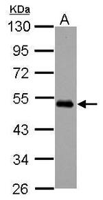 MEIS2 Antibody in Western Blot (WB)