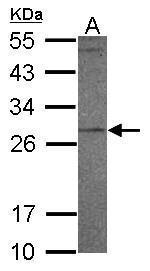 PR3 Polyclonal Antibody