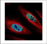 hnRNP A2B1 Polyclonal Antibody