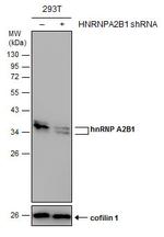 hnRNP A2B1 Antibody in Western Blot (WB)
