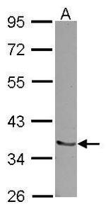 Pirh2 Antibody in Western Blot (WB)