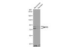 MPP5 Polyclonal Antibody