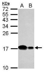 UBE2D2 Antibody in Western Blot (WB)