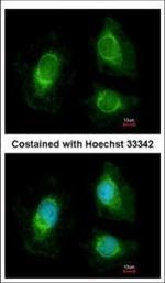 RRP4 Polyclonal Antibody