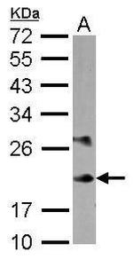 MYL6B Polyclonal Antibody