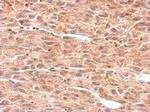 OMD Polyclonal Antibody