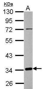 C10orf4 Antibody in Western Blot (WB)